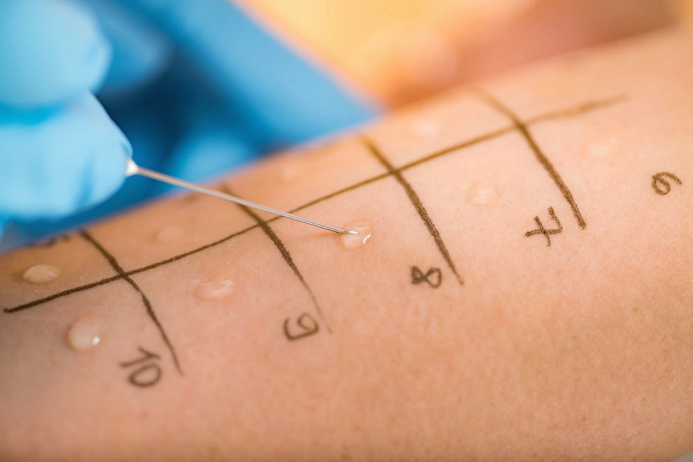 Misconceptions About Tuberculosis Testing & PPD Testing